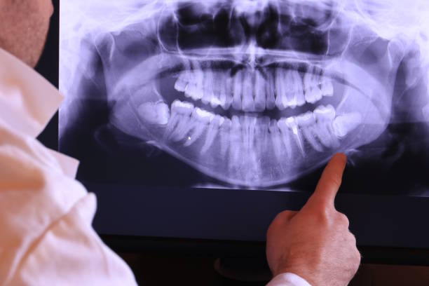 Best 24-Hour Emergency Dental Care in Iraan, TX