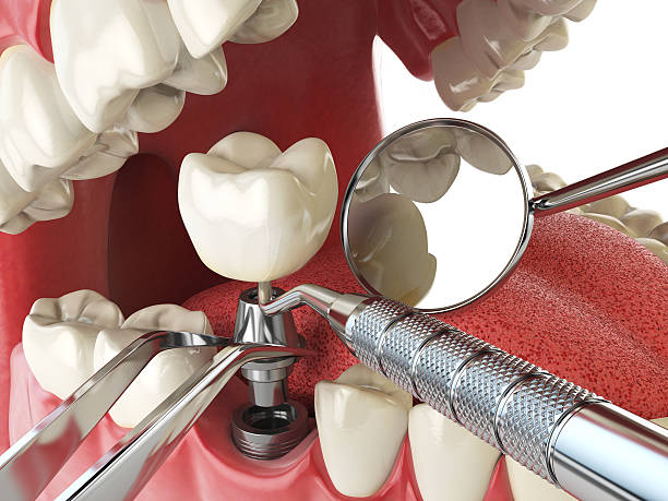 Best Emergency Treatment for Jaw Pain or Injury in Iraan, TX