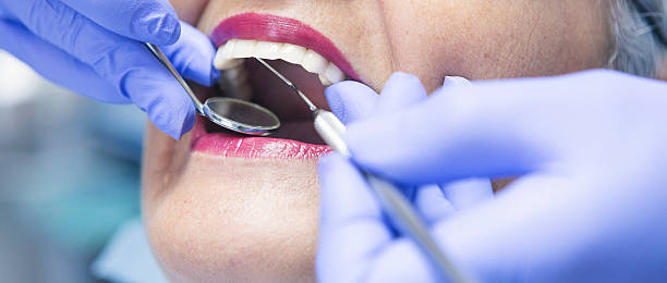 Best Dental Abscess Treatment in Iraan, TX